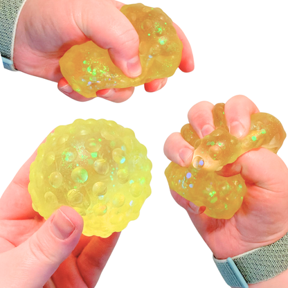 KTL Squishy & Stretchy Glitter Pimple Stress Ball